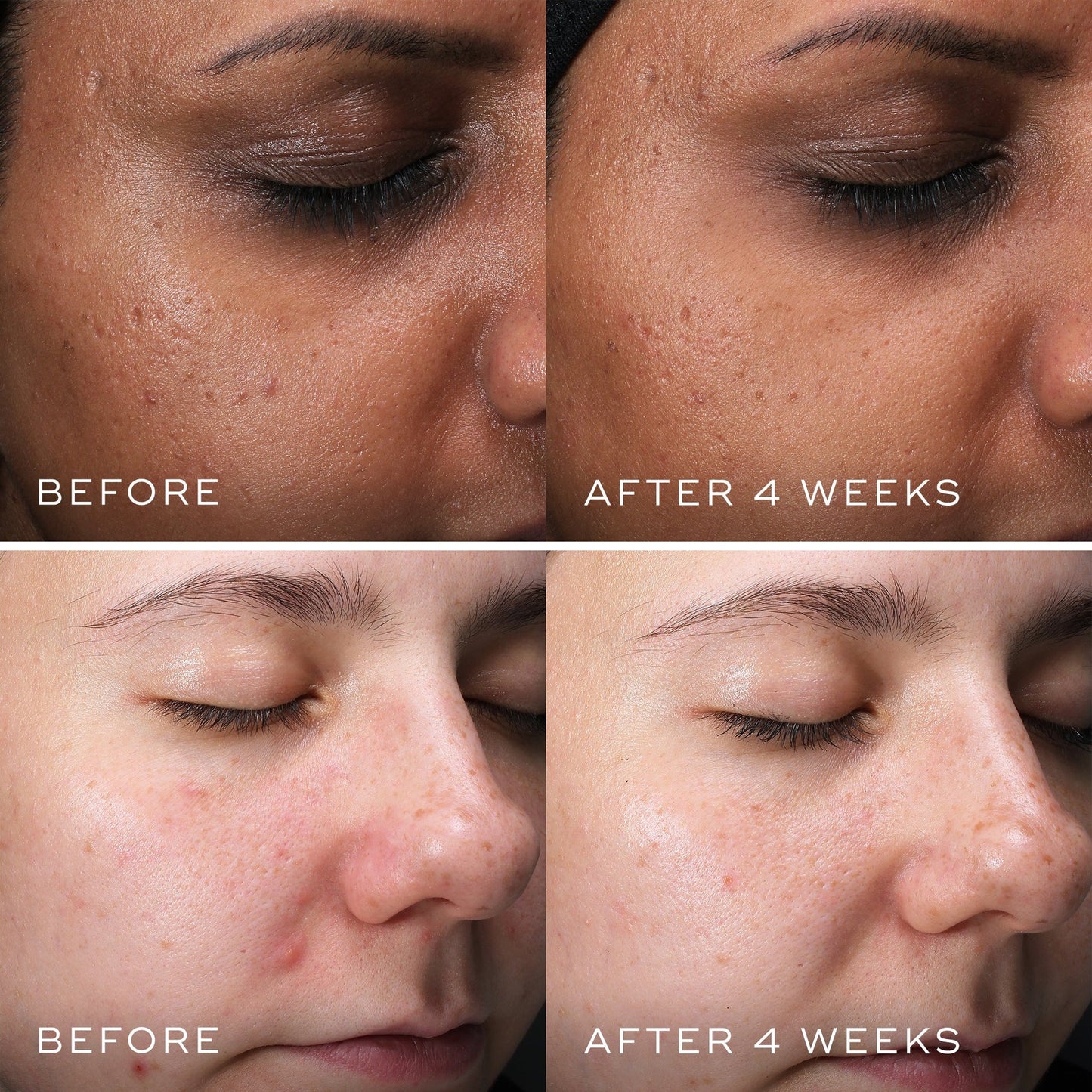 Medik8 Clarity Peptides 30 Ml