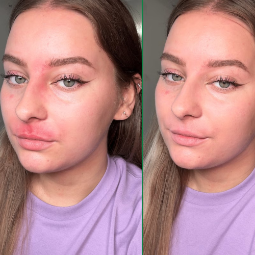 Dr.Jart+ Cicapair™ Tiger Grass Color Correcting Treatment 50 ml