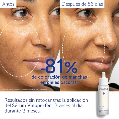 Caudalie Vinoperfect Sérum Resplandor Antimanchas 50 ml