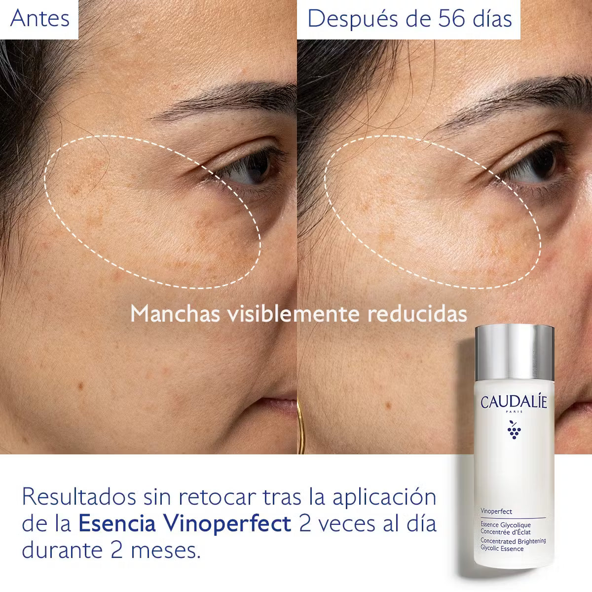 Caudalie Vinoperfect Esencia Glicólica Luminosidad 100 ml