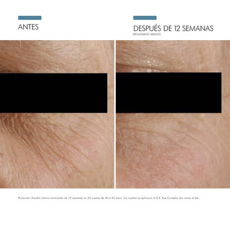 Skinceuticals Age Eye Complex 1 Tarro 15 G