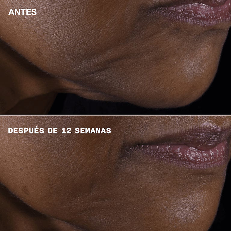 Clinique Smart Repair Lifting Face + Neck Cream 50 ml