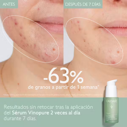 Caudalie Vinopure Serum Salicilico Anti-Imperfecciones 30Ml