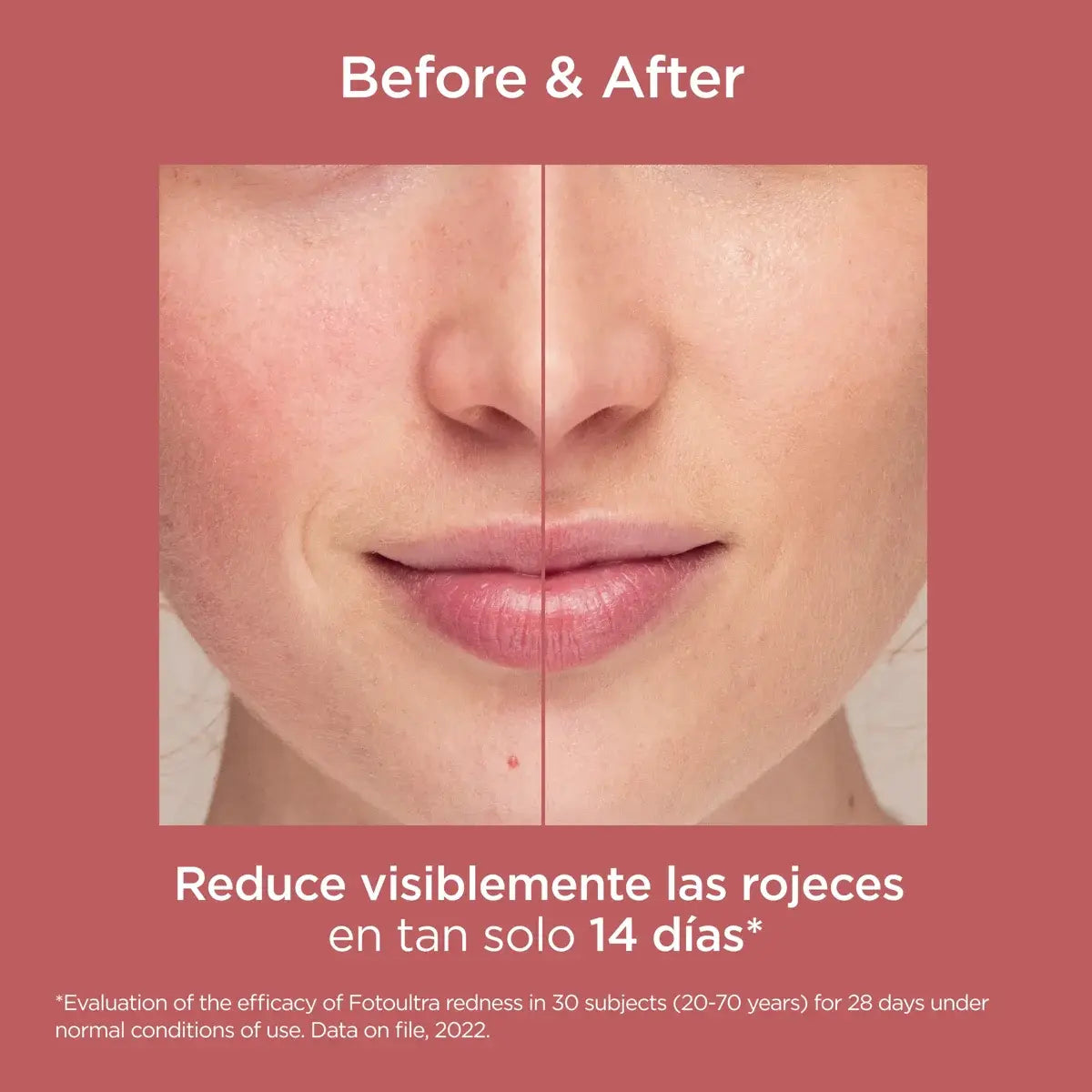 Isdin Fotoultra Redness 1 Frasco 50 Ml