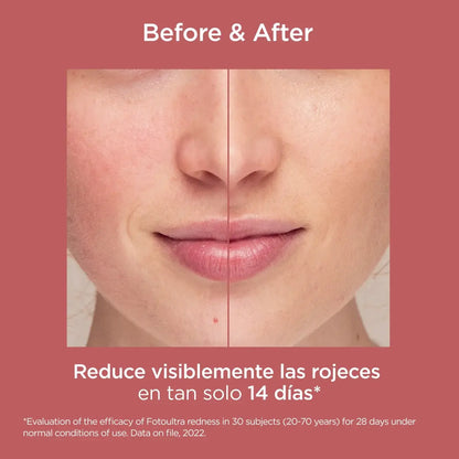 Isdin Fotoultra Redness 1 Frasco 50 Ml