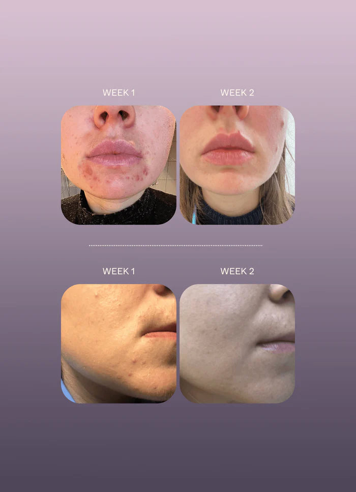 Herbar Face Nectar 30 Ml