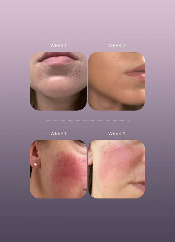 Herbar Face Oil 15 Ml