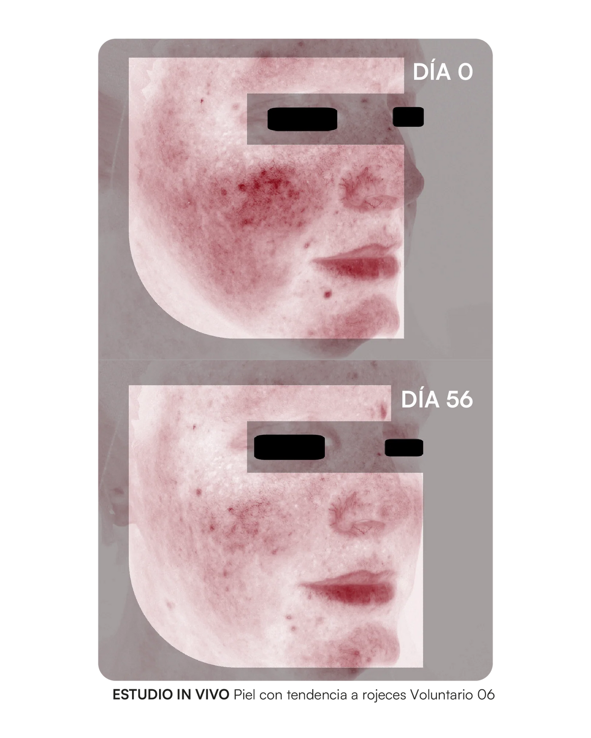 Gema Herrerías Probioderm Balance 30 Cápsulas