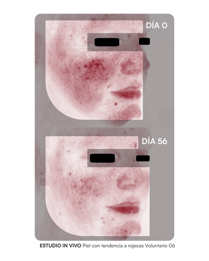 Gema Herrerías Probioderm Balance 30 Cápsulas