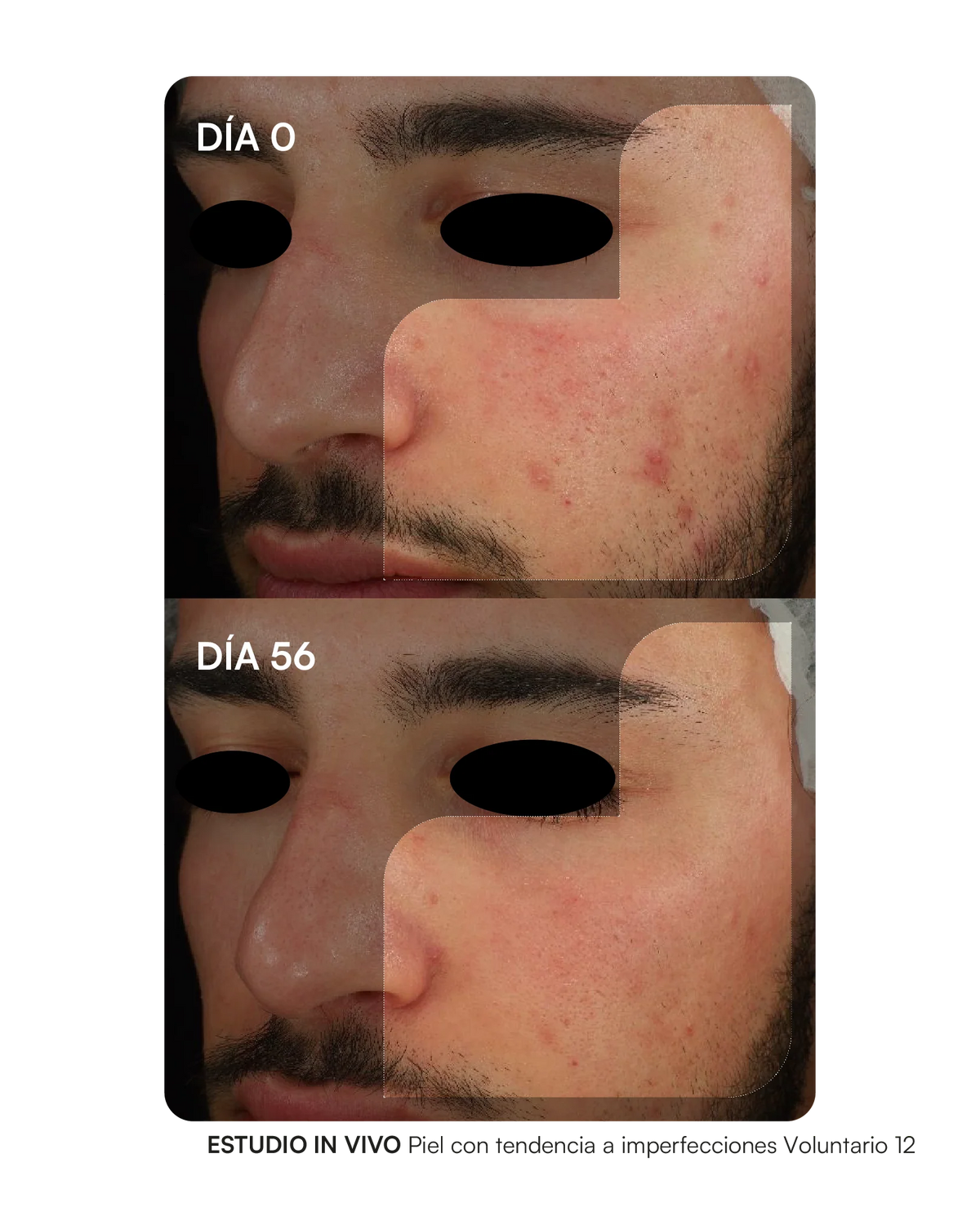 Gema Herrerías Probioderm Balance 30 Cápsulas