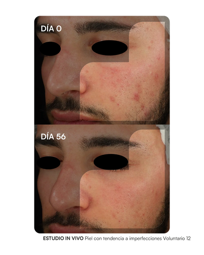 Gema Herrerías Probioderm Balance 30 Cápsulas