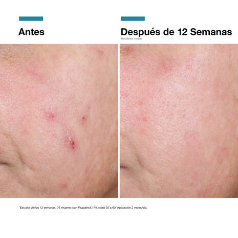 SkinCeuticals Advanced RGN‑6 50 ml
