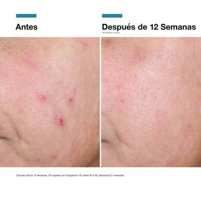 SkinCeuticals Advanced RGN‑6 50 ml