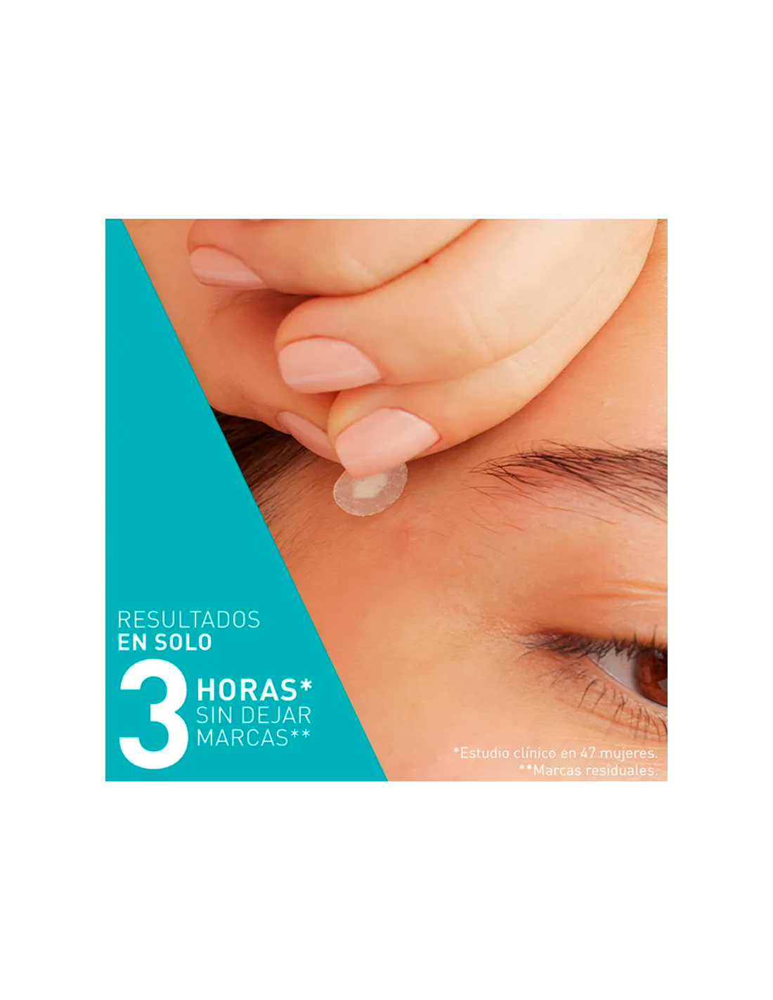 CeraVe Parches Control Imperfecciones 22 Unidades