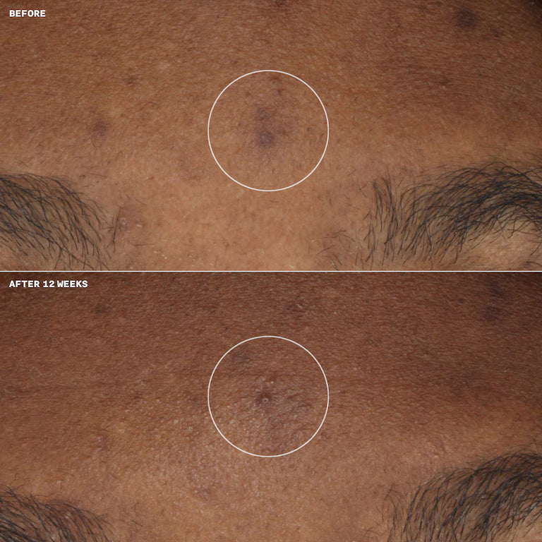 Clinique Even Better Clinical Brightening Moisturizer 50 ml