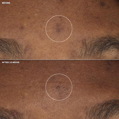 Clinique Even Better Clinical Brightening Moisturizer 50 ml