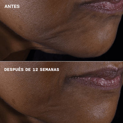 Clinique Smart Repair Lifting Face + Neck Cream 50 ml