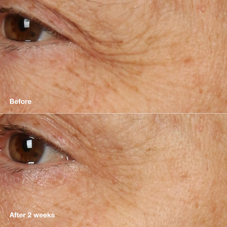 Clinique Smart Clinical Repair Overnight Recovery Cream + Mask 50 ml