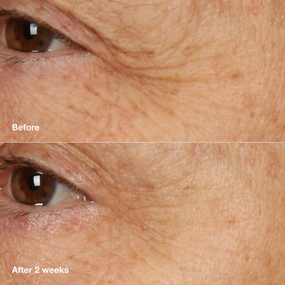 Clinique Smart Clinical Repair Overnight Recovery Cream + Mask 50 ml