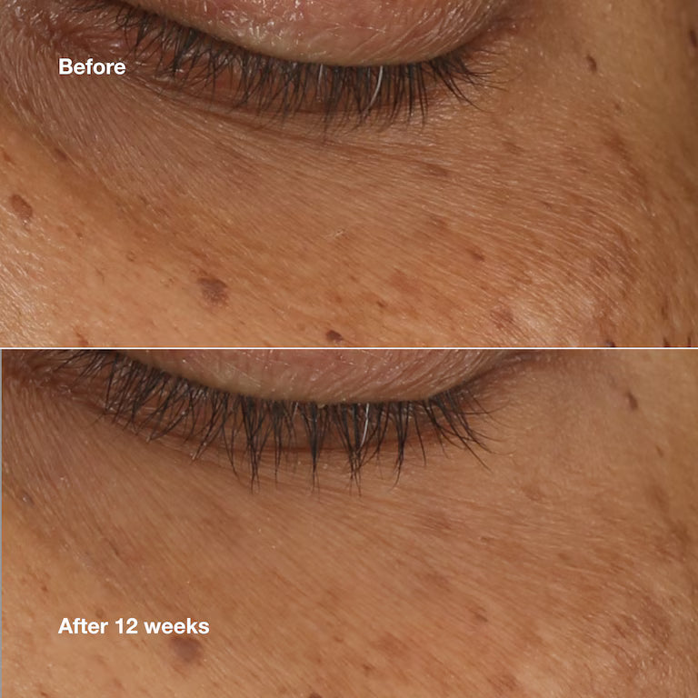 Clinique All About Eyes Brightening Serum Concentrado 10 ml