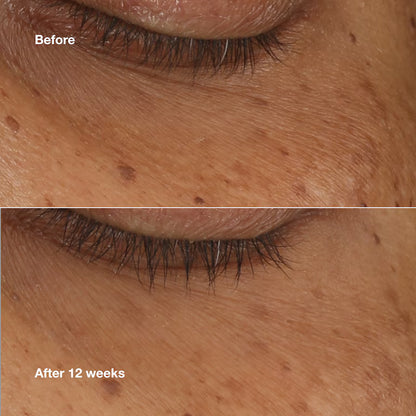 Clinique All About Eyes Brightening Serum Concentrado 10 ml