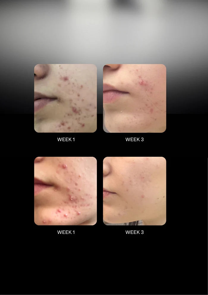 Herbar Barrier Cream 50 G